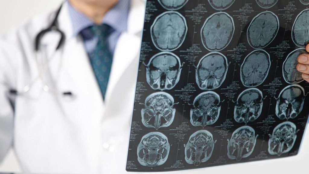 pandemi-beyni-yaslandirdi:-covid-olmasaniz-bile-etkilenmis-olabilirsiniz