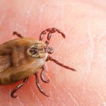 Sivas’ta Kırım Kongo Kanamalı Ateşi Şüphesiyle Bir Can Kaybı Daha